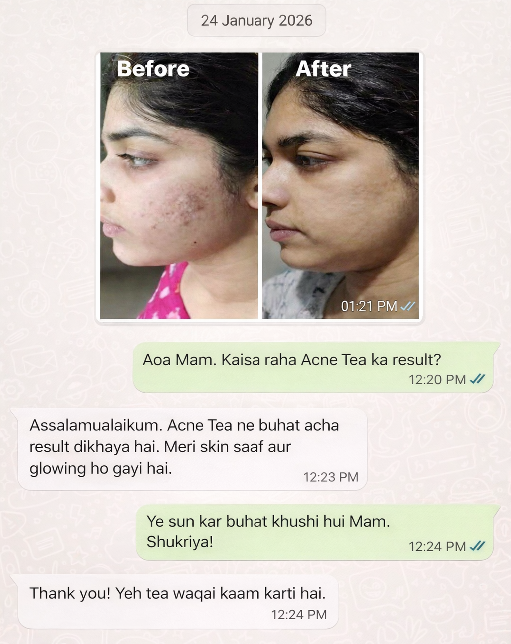 Acne treatment results WhatsApp